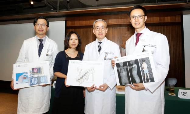 (From left) Dr Kenneth Wong (Clinical Associate Professor and Chief of Division of Paediatric Surgery of Department of Surgery), patient’s mother Mrs Cho, Professor Kenneth Cheung (Head of Department of Orthopaedics and Traumatology) and Dr Kenny Kwan (Clinical Assistant Professor of Department of Orthopaedics and Traumatology).