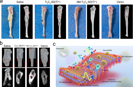 HKUMed invents a novel two-dimensional (2D) ultrasound-responsive antibacterial nano-sheets to effectively address bone tissue infection 